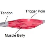What Are Muscle Bellies