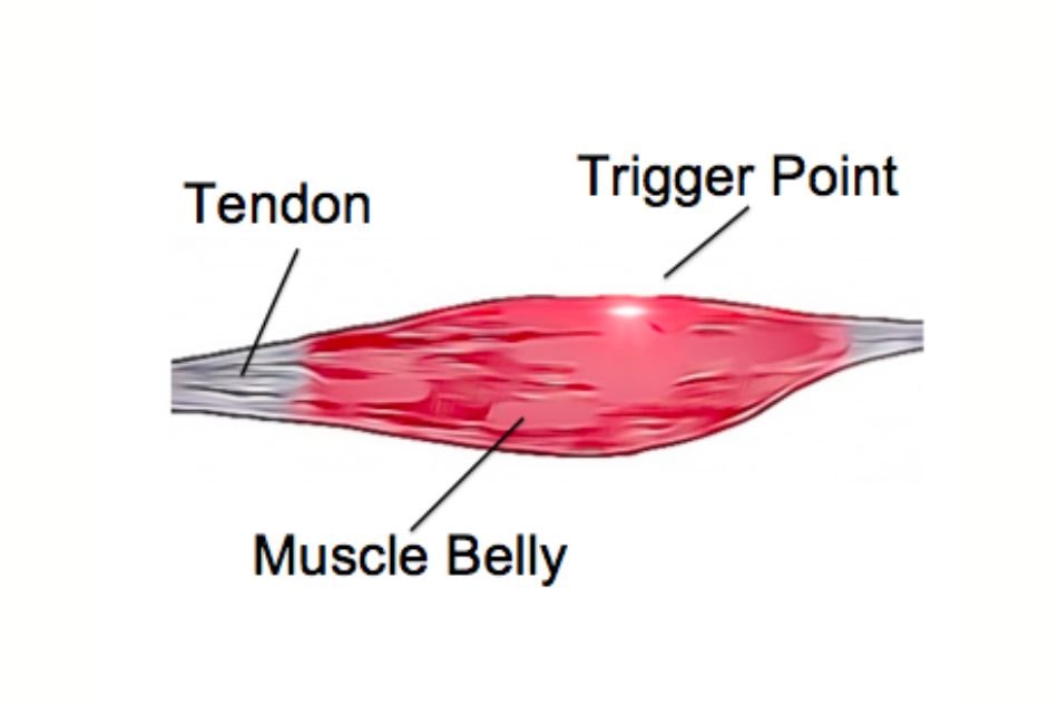 What Are Muscle Bellies