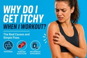 Why Do I Get Itchy When I Workout